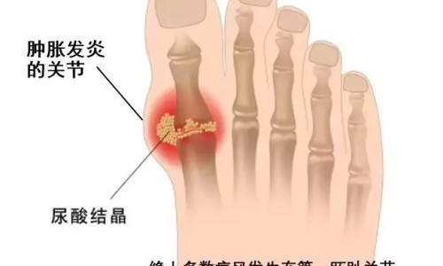 糖尿病人群健身指南-糖尿病人健忘网—知名的糖尿病人健忘怎么回事网站,分享糖尿病健忘能治好吗知识
